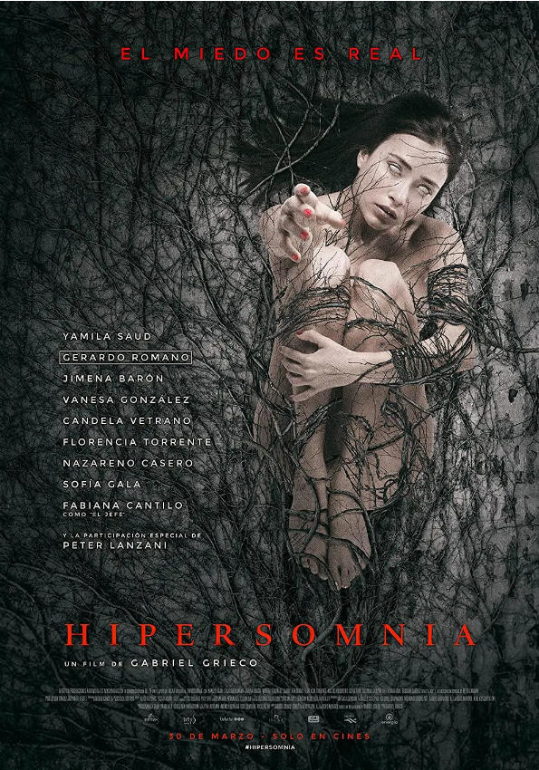 嗜睡症 Hipersomnia (2017)